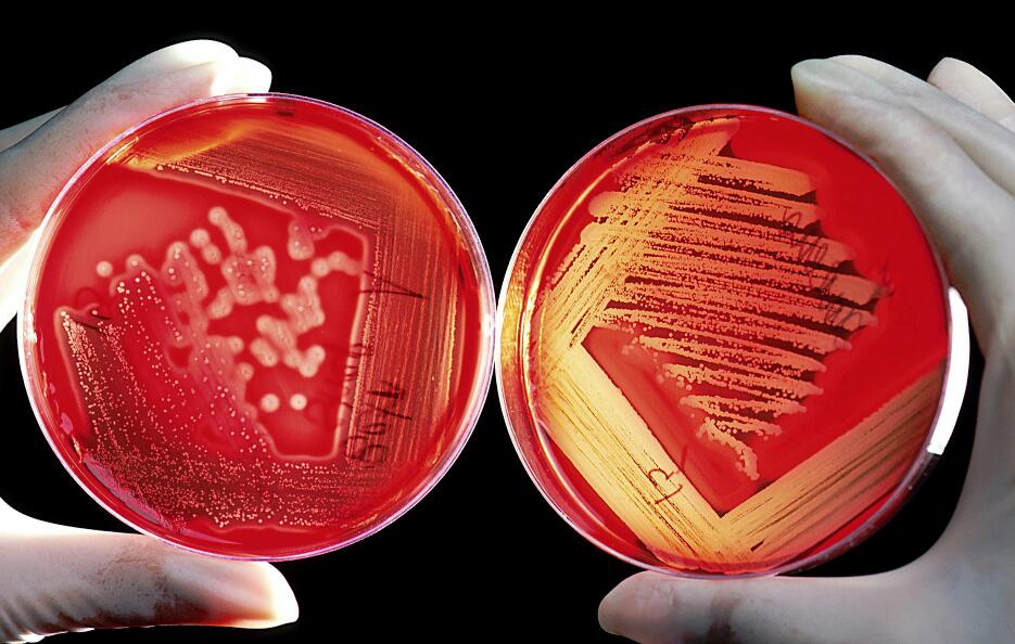 用于抗真菌水性涂料的液體殺生物劑組分的有效性 涂料在線,coatingol.com